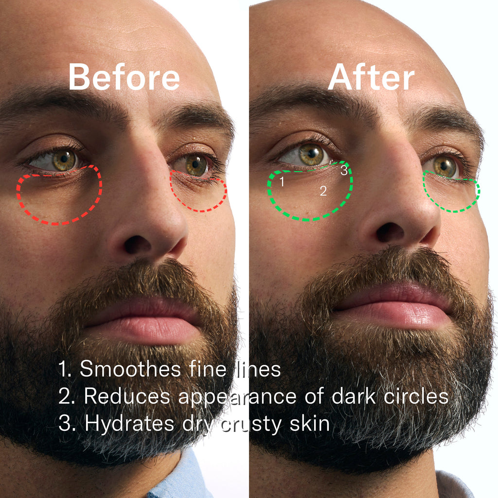 Rapid Restore Eye Patches - 6 pack - Modern Blade Refills