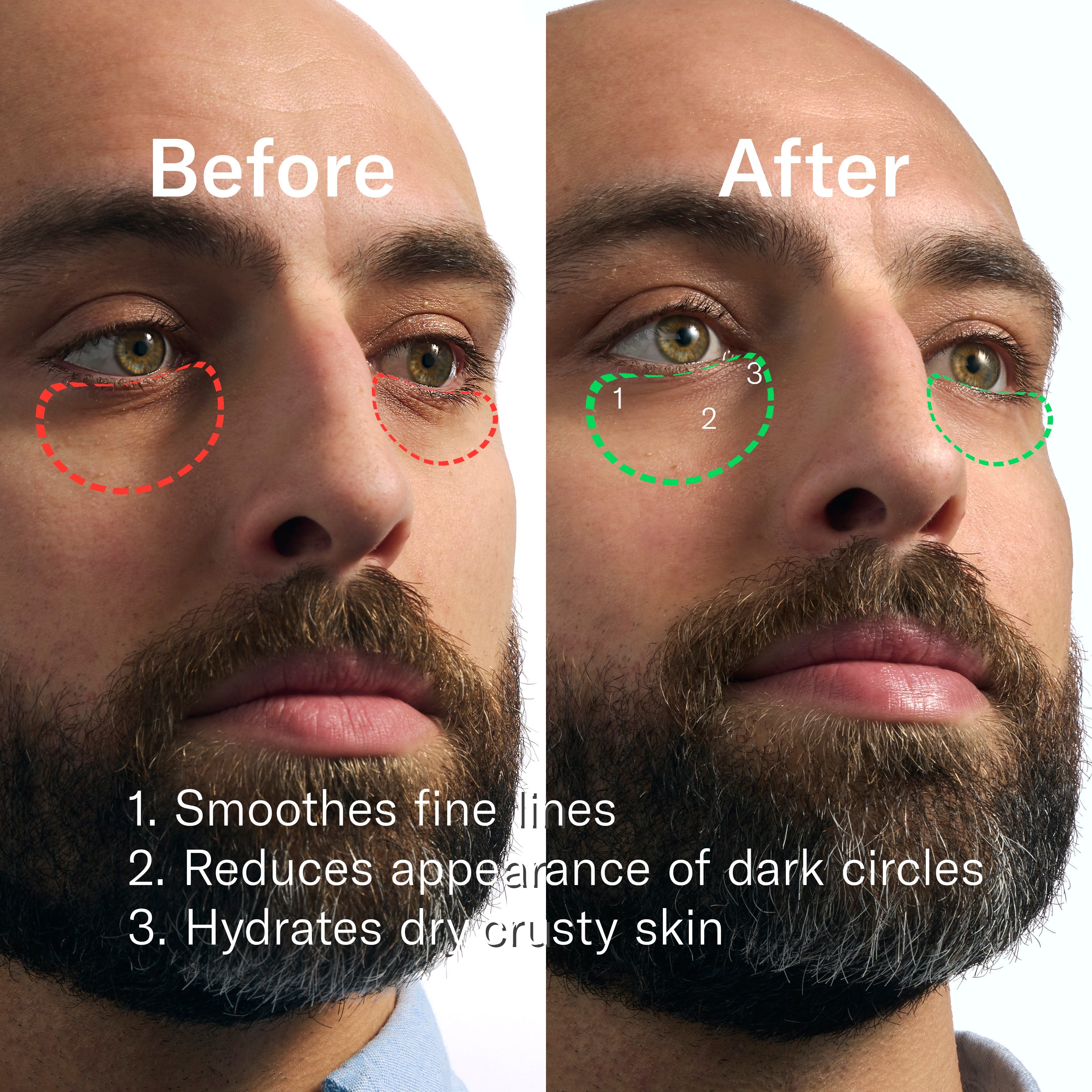 Rapid Restore Eye Patches - 6 pack - Modern Blade Refills
